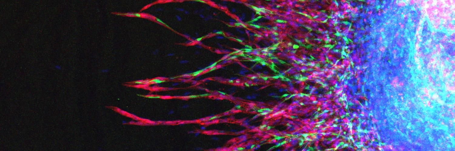 Angiogenesis