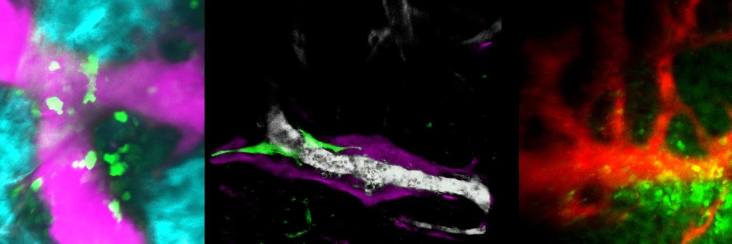 stem cells