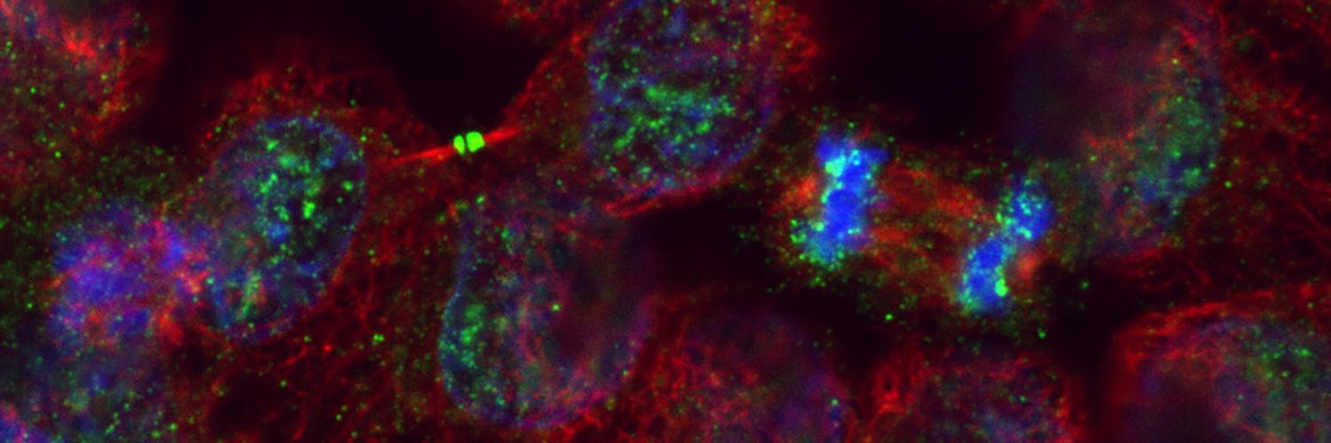 Human cancer cells 