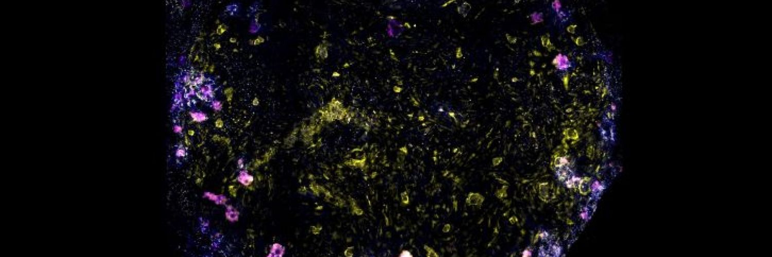 Lung-on-chip