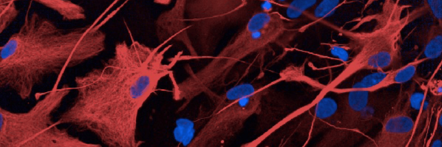 Astrocytes