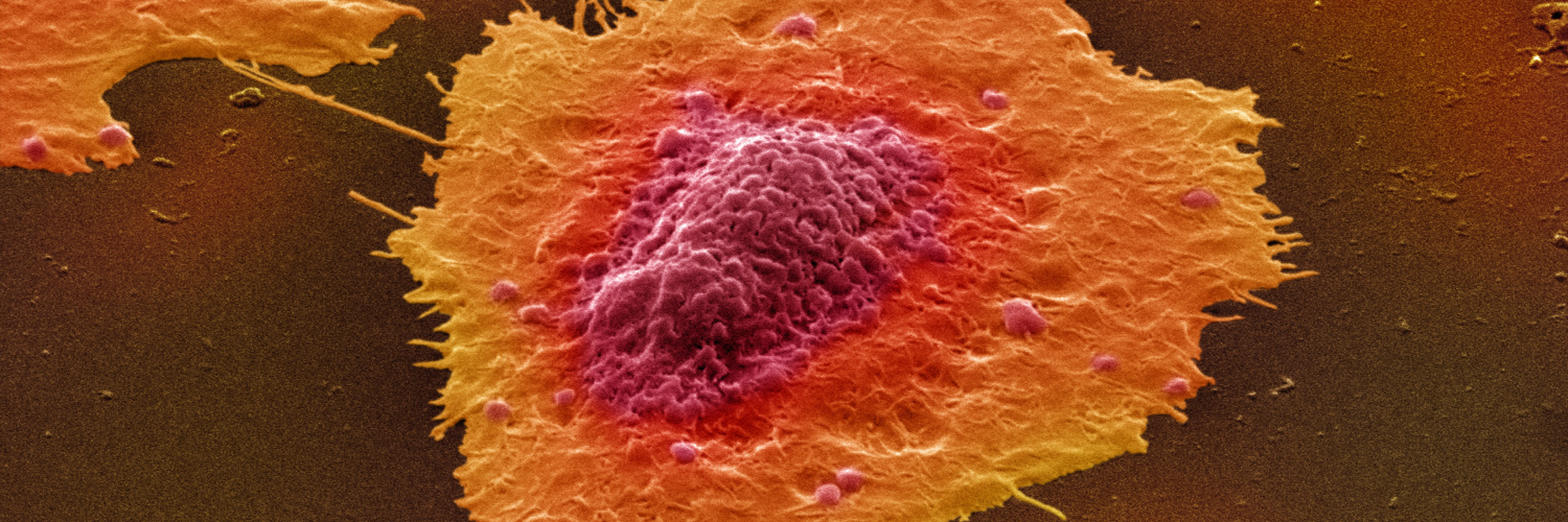 Colour-enhanced image of human colon cancer cells in culture